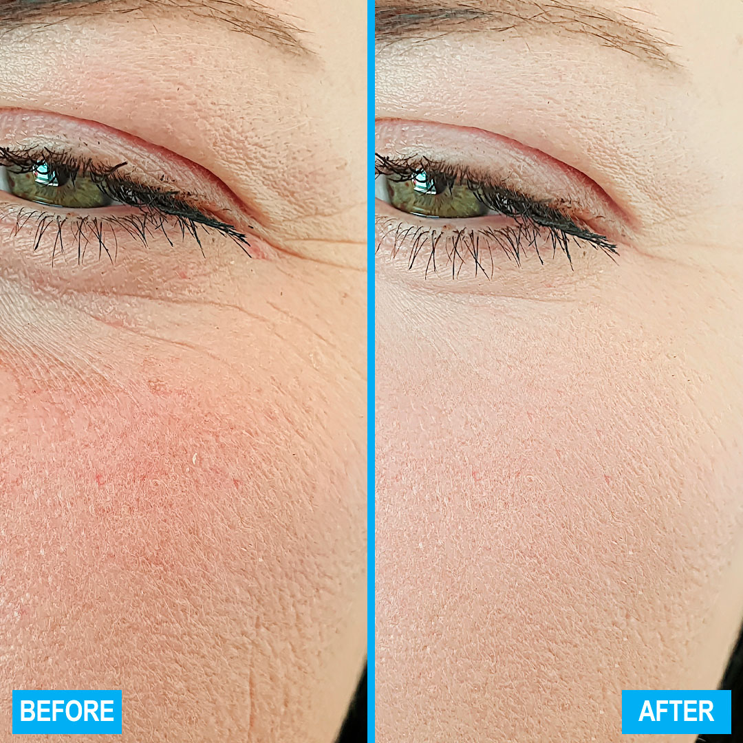dr-levy-switzerland-skin-care-beauty-product-booster-cream-before-after.jpg