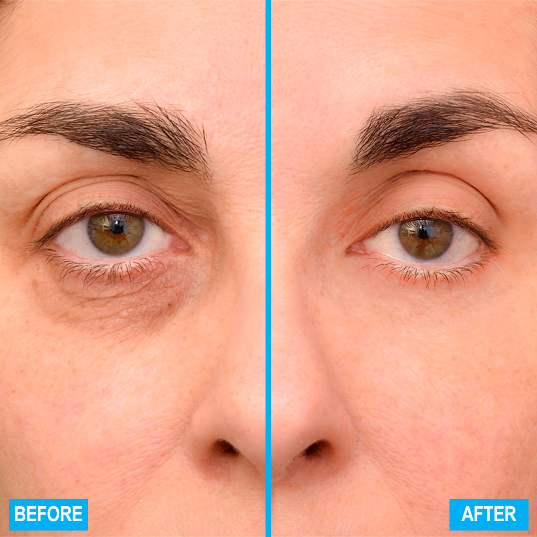 dr-levy-switzerland-skin-care-beauty-product-booster-cream-before-after.jpg